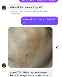 melasma repair combo review (4)