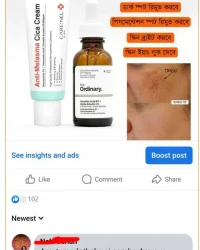 melasma repair combo review (5)